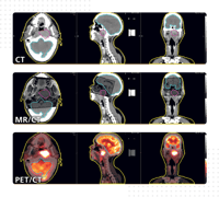 MIM Maestro® Image Registration | MIM Software
