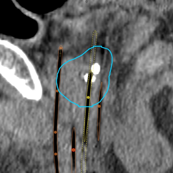 MIM Symphony HDR Fusion | MIM Software