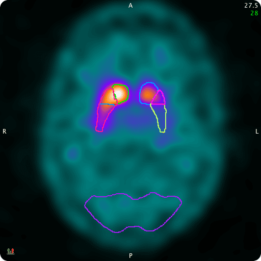 NM-Neuro-Img02