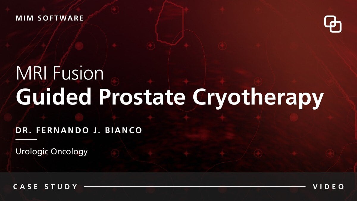 MIM Software MRI Fusion  Guided Prostate Cryotherapy Dr. Fernando J. Bianco Urologic Oncology CASE STUDY VIDEO