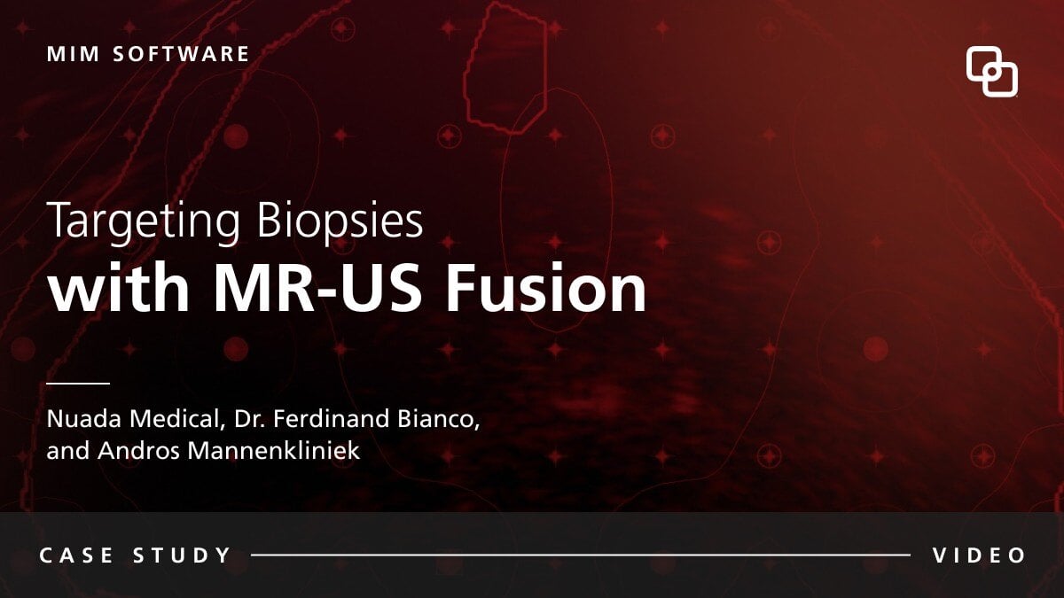 MIM Software Targeting Biopsies  with MR-US Fusion Nuada Medical, Dr. Ferdinand Bianco, and Andros Mannenkliniek CASE STUDY VIDEO