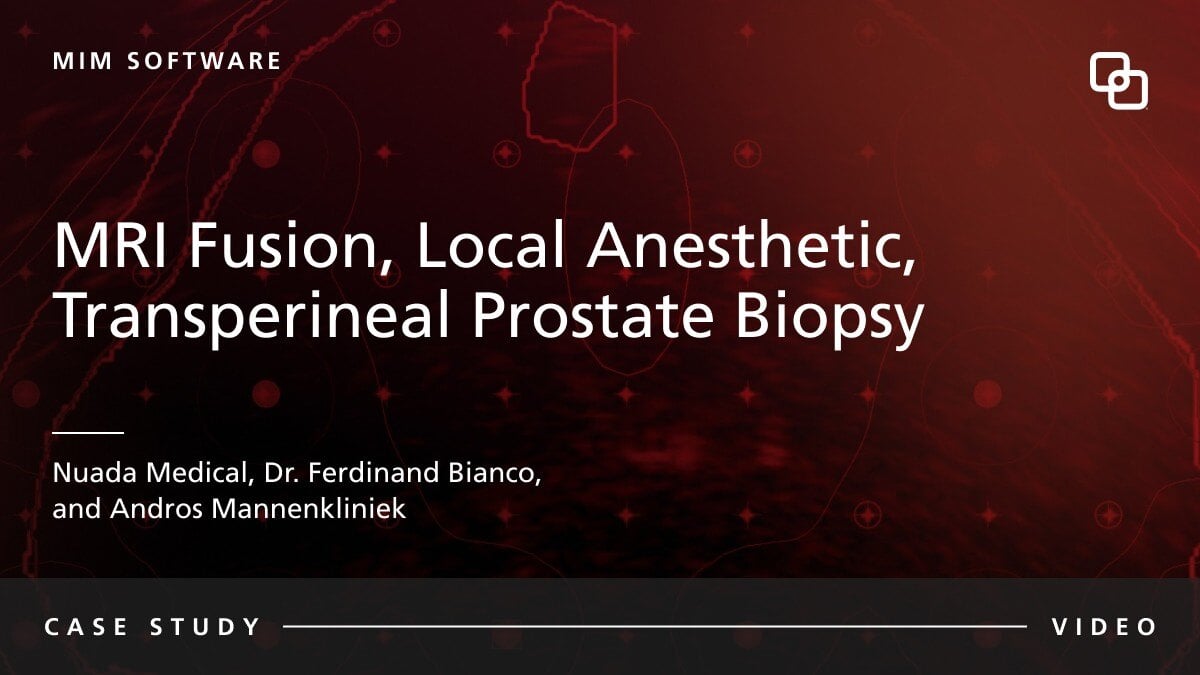 MIM Software MRI Fusion, Local Anesthetic,  Transperineal Prostate Biopsy Nuada Medical, Dr. Ferdinand Bianco, and Andros Mannenkliniek CASE STUDY VIDEO